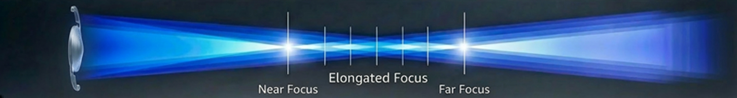 연속초점 초점 설명 이미지